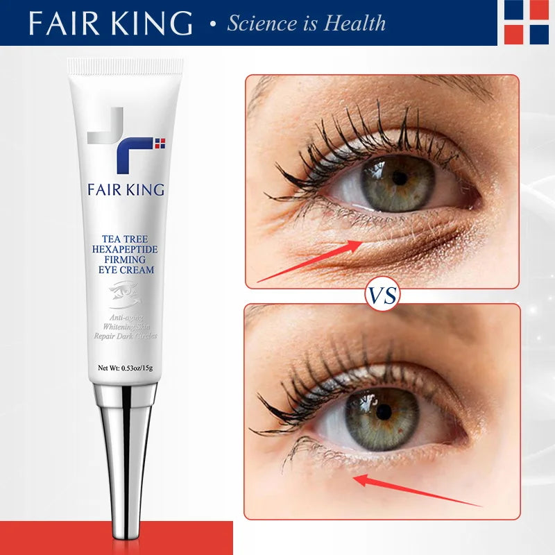 Fair King eye cream with before and after effects on eye area