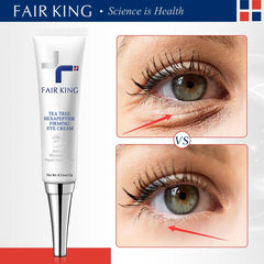 Fair King eye cream with before and after effects on eye area