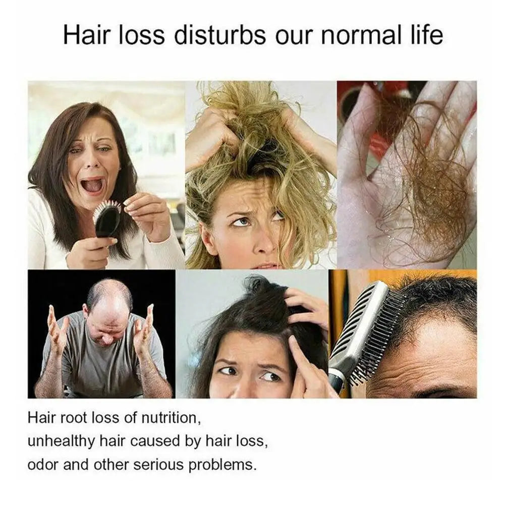 Meme showing various people dealing with hair loss and its effects.