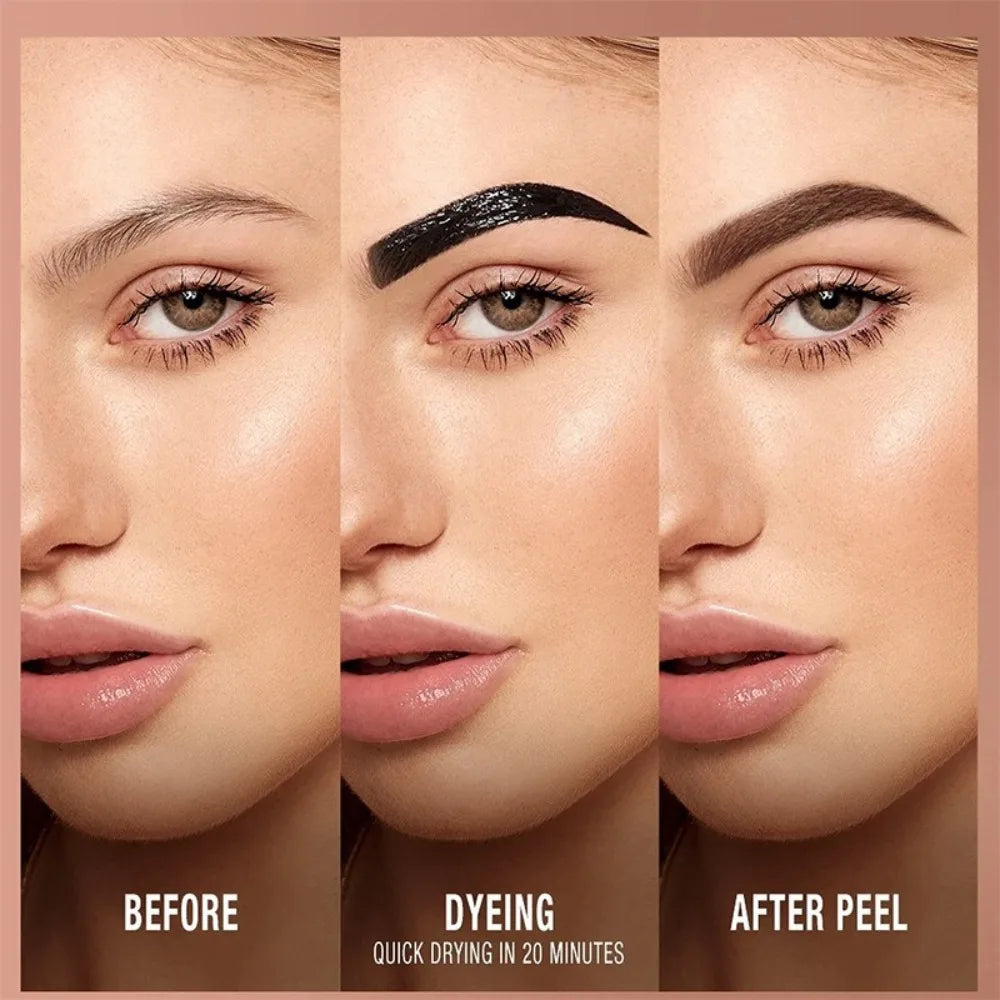 Before and after comparison of a cosmetic treatment on a woman's face.