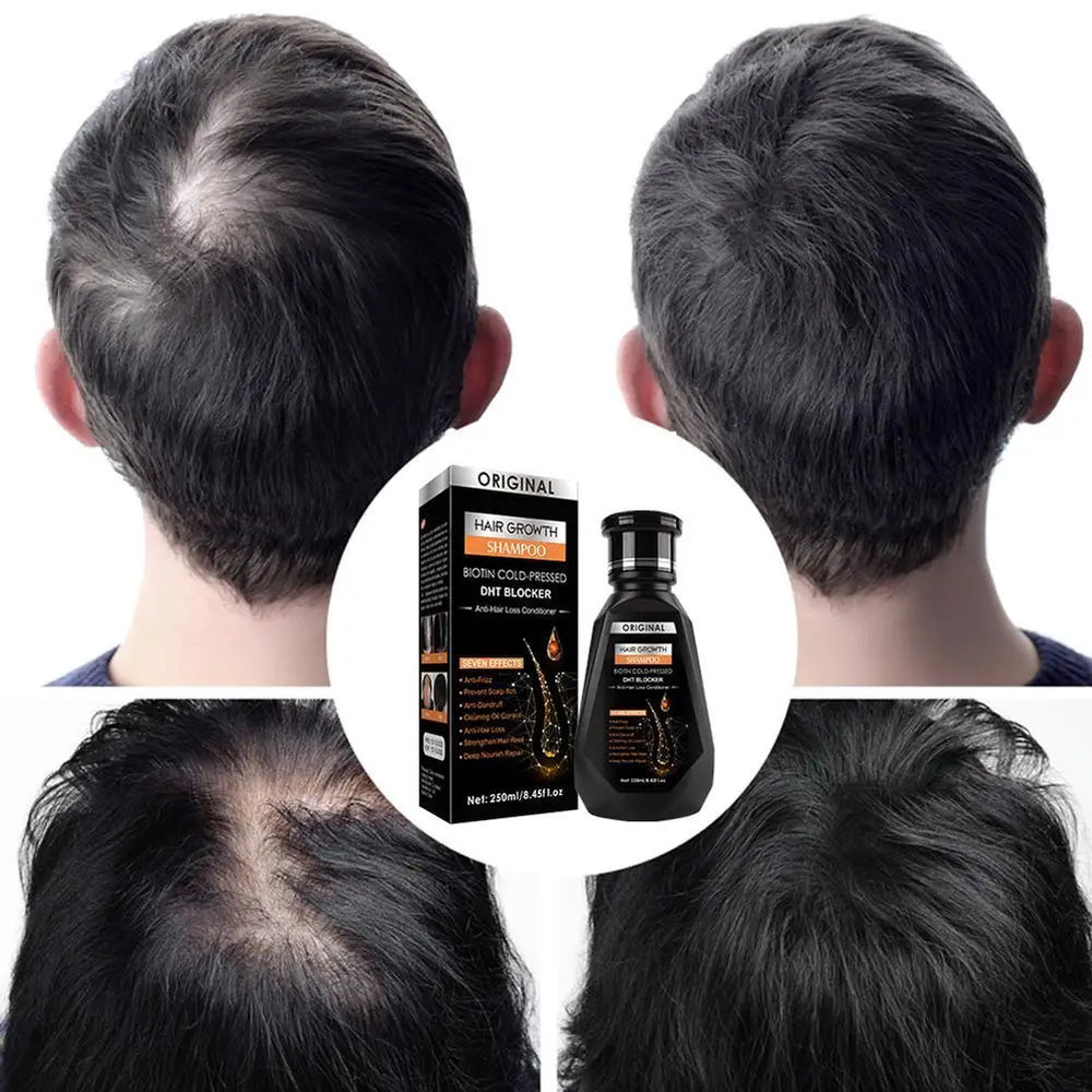 Before and after comparison of hair growth with a hair growth product packaging.