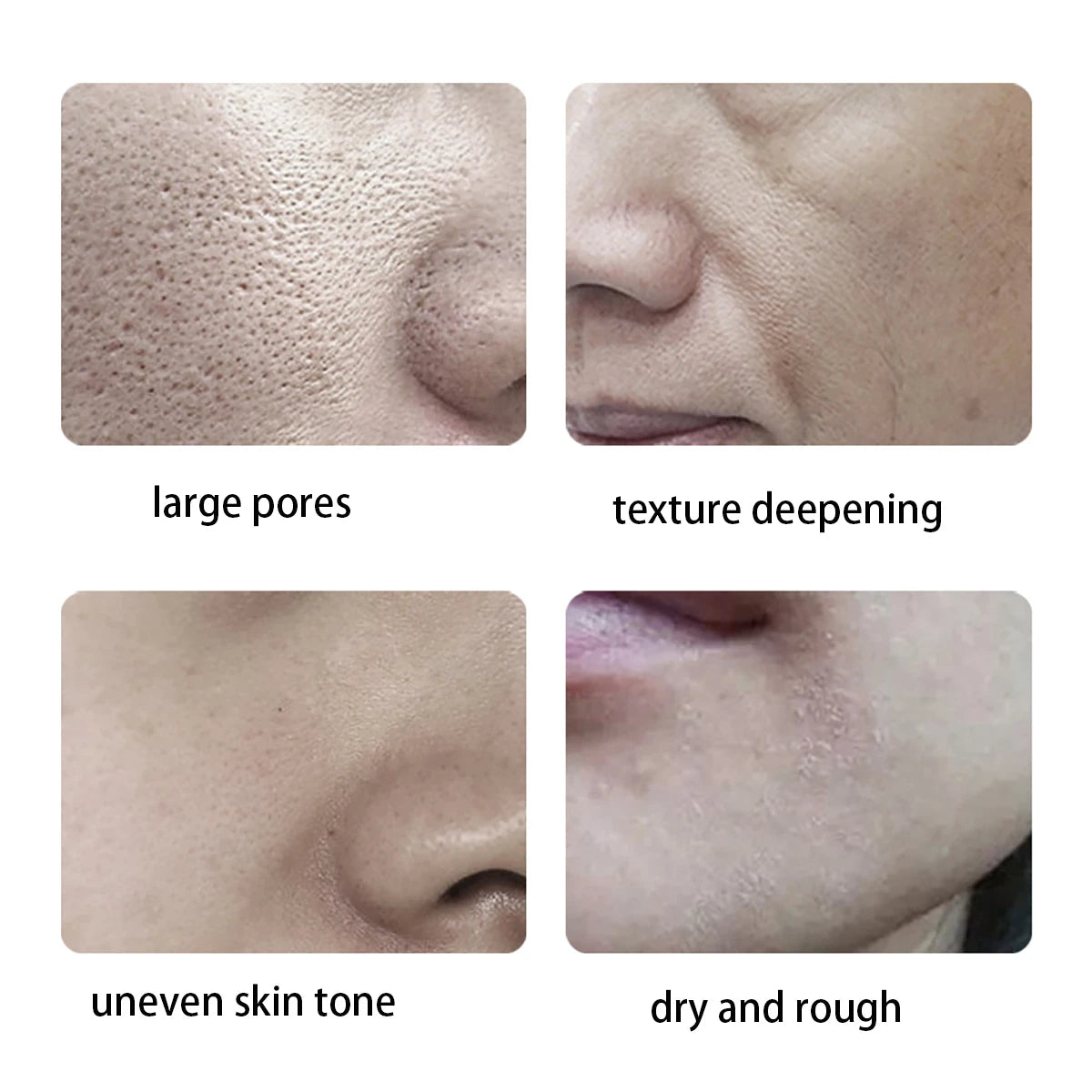 Four images showing different skin texture issues: large pores, texture deepening, uneven skin tone, and dry and rough skin.