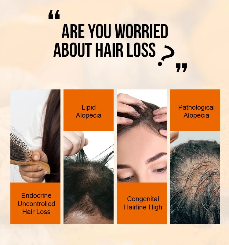 Promotional graphic about hair loss with images and text on a beige background