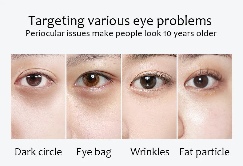 Collage of eyes with different eye issues labeled: dark circles, eye bags, wrinkles, fat particles.