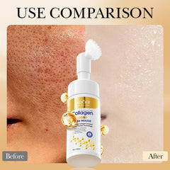 Skincare product with 'Before' and 'After' skin comparison on a beige background