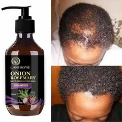 Lanthome Onion Rosemary Mint Strengthening Shampoo bottle with before and after hair growth images.