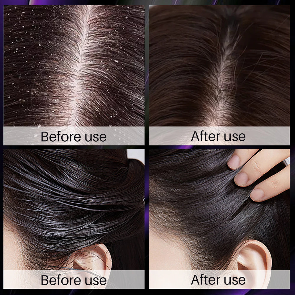 Before and after comparison of hair treatment on a person's scalp.