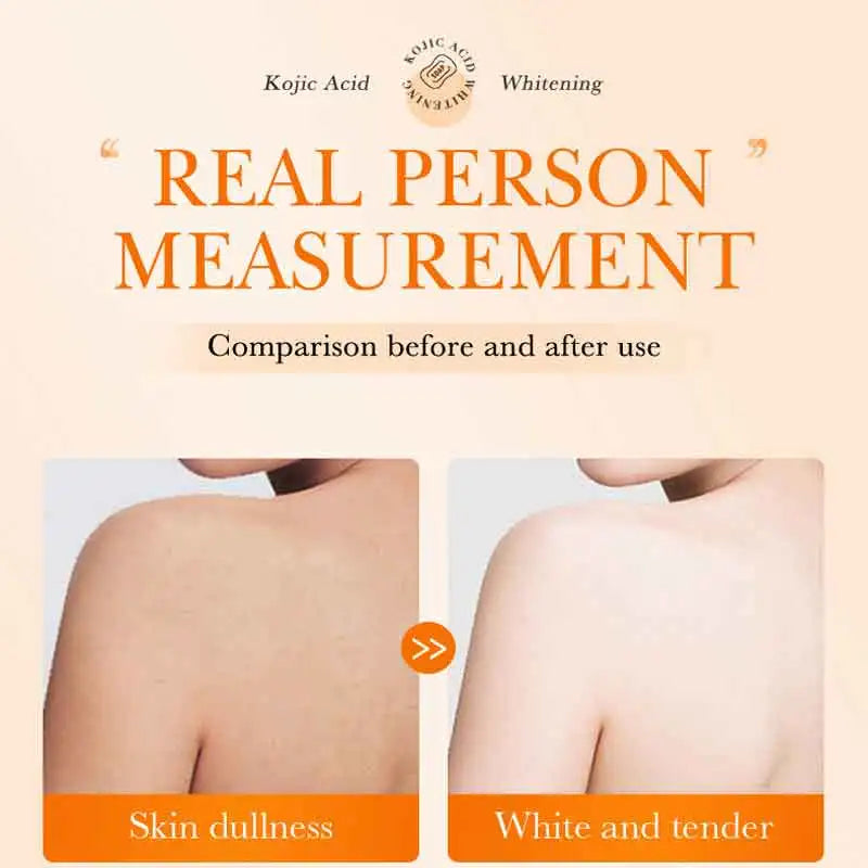 Before and after comparison of skin dullness to white and tender with Kojic Acid Whitening.