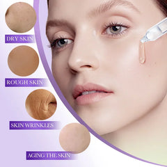 Close-up of a woman's face with skin conditions labeled on a purple background