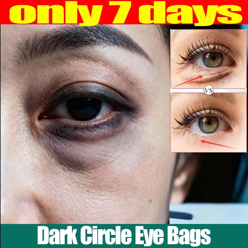 Advertisement for dark circle eye bags treatment with close-up of eye and comparison before and after.