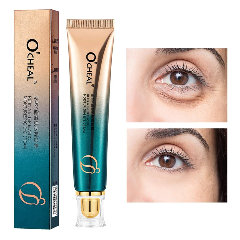 O'CHEAL eye cream tube and packaging with close-up of eyes showing results.