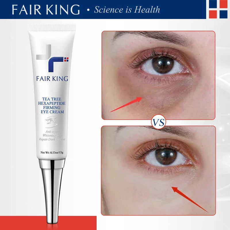 Fair King eye cream with before and after effects on eyes shown.
