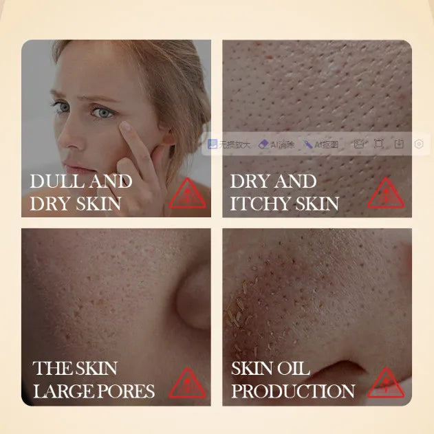 Collage of skin conditions with text labels on a beige background