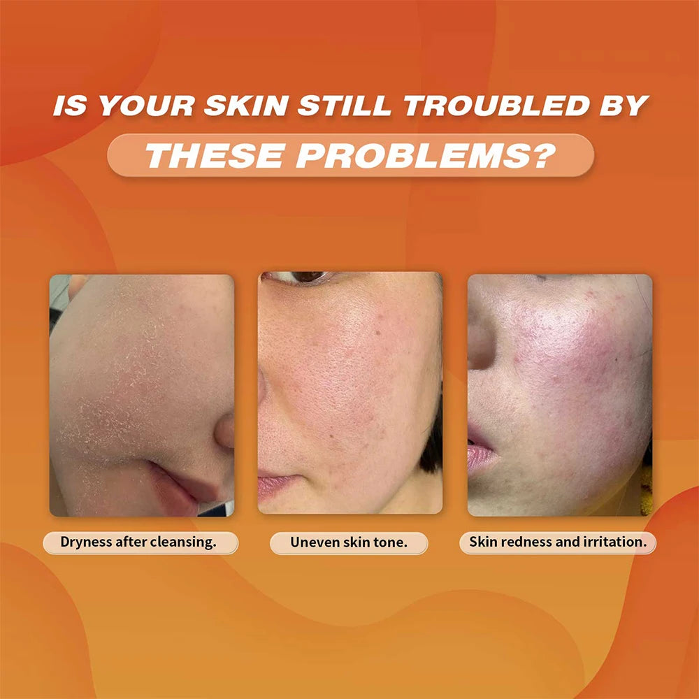 Turmeric Foam Cleanser | Deep Cleansing, Skin Brightening & Lemon Extract Wash